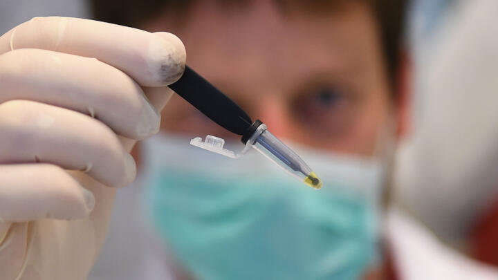 A resercher from the Sys2Diag laboratory, of the biotechnology company SkillCell, shows a EasyCov fast-acting saliva-based test display yellow reagent negative at the Covid-19 disease, on April 30, 2020, in Montpellier, southern France.